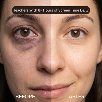 Brighter, Restored Under Eyes in 10 Minutes With LUMIVEIL